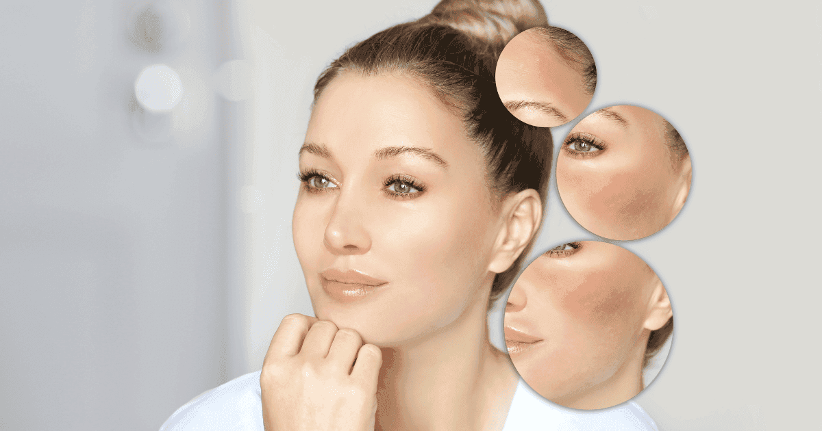 Uống collagen có trị được nám không? Chuyên gia giải đáp