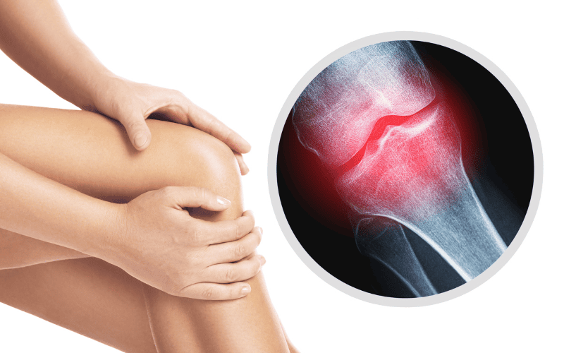 Uống Collagen có tốt cho xương khớp không