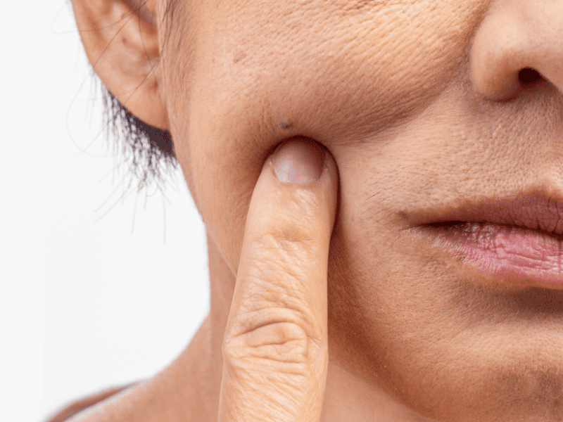 Nhóm đối tượng nên cân nhắc bổ sung collagen Nhật Bản vào chế độ chăm sóc sức khỏe và sắc đẹp