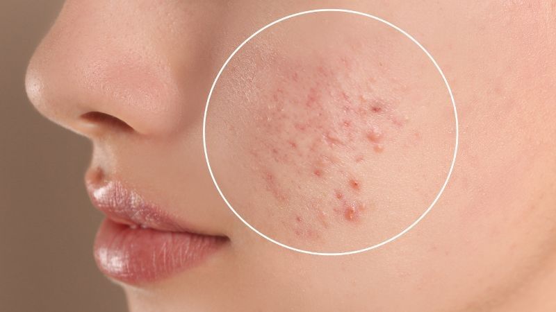 Lắng nghe cơ thể là bước quan trọng để biết khi nào nên dừng lại hoặc điều chỉnh việc uống collagen sao cho hợp lý