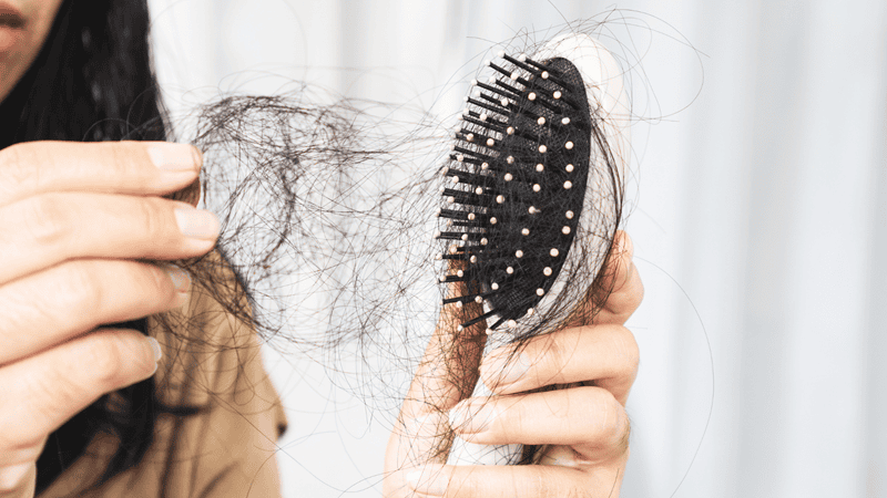 Rối loạn nội tiết hậu Covid gây rụng tóc