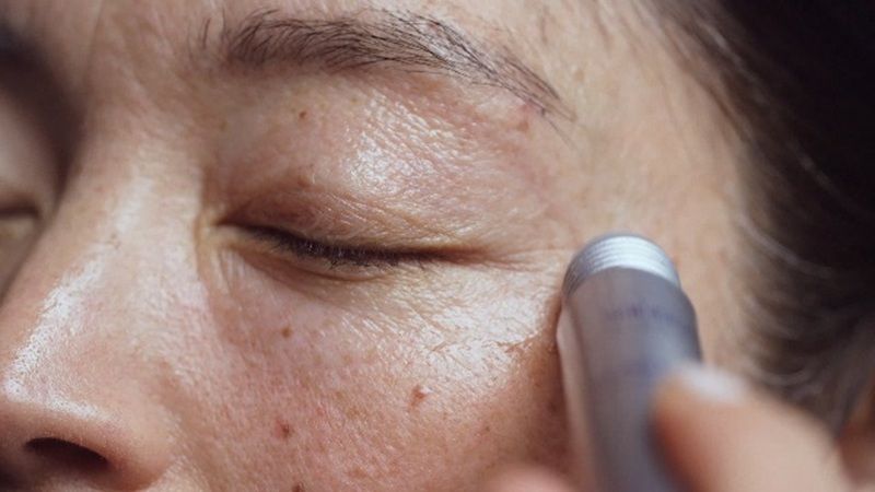 Tại sao cần sử dụng serum mắt?