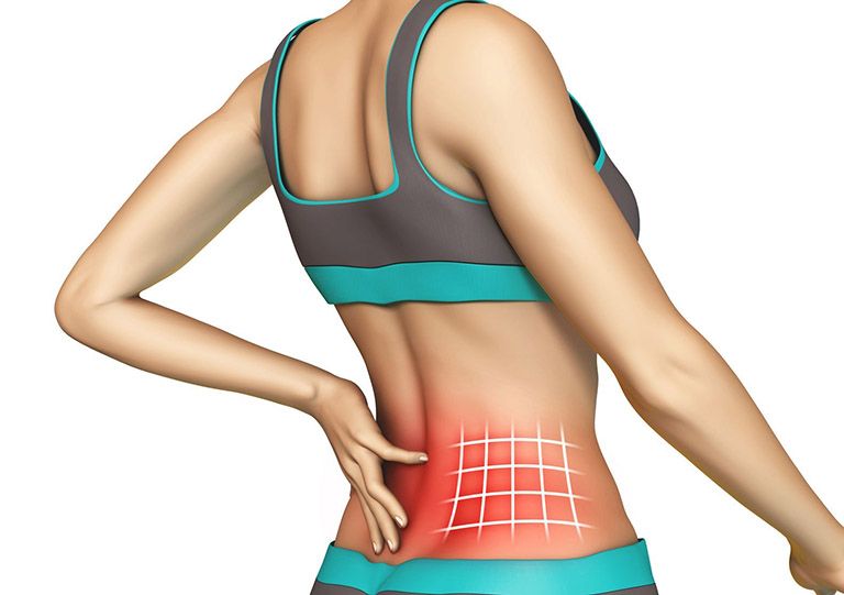 Giãn dây chằng gây đau lưng