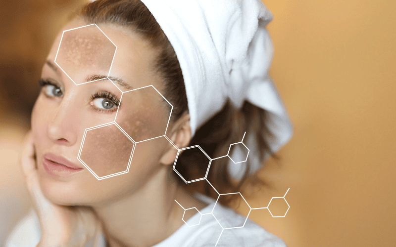Theo các chuyên gia, collagen không phải là thuốc đặc trị nám da tuy nhiên có thể hỗ trợ điều trị nám da