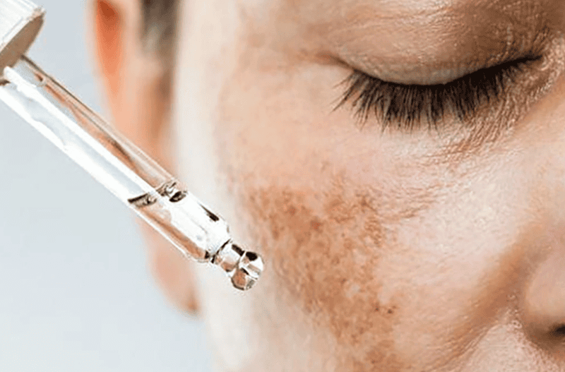 Công dụng của serum trị nám