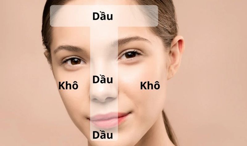 Da hỗn hợp là gì?