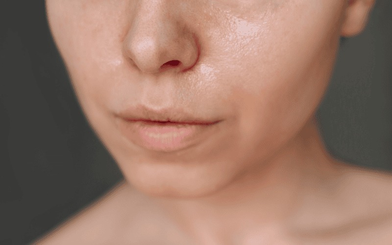 Cần chọn collagen cho da hỗ hợp cần nhẹ nhàng, không gây bít tắc lỗ chân lông