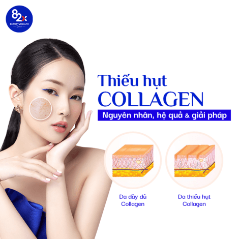 Thiếu hụt collagen: Dấu hiệu, nguyên nhân và giải pháp