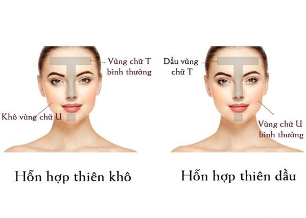 Da Hỗn Hợp