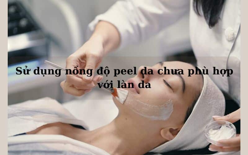 peel da bao nhiêu ngày thì bong