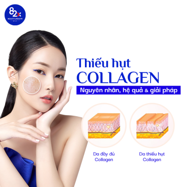 thieu-hut-collagen