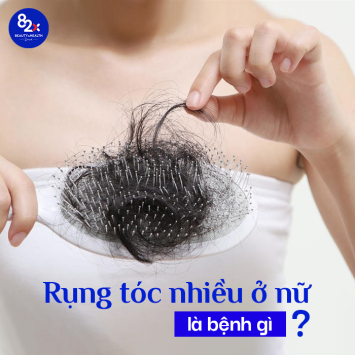 Rụng tóc nhiều ở nữ: Nguyên nhân và cách điều trị hiệu quả